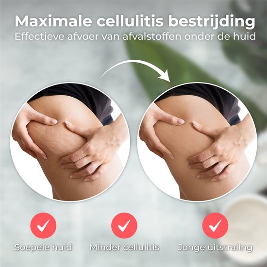 Cupping tegen spierklachten & cellulites