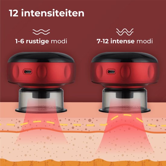 Cupping tegen spierklachten & cellulites