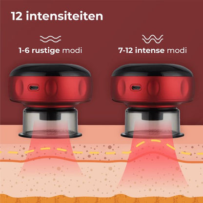 Cupping tegen spierklachten & cellulites