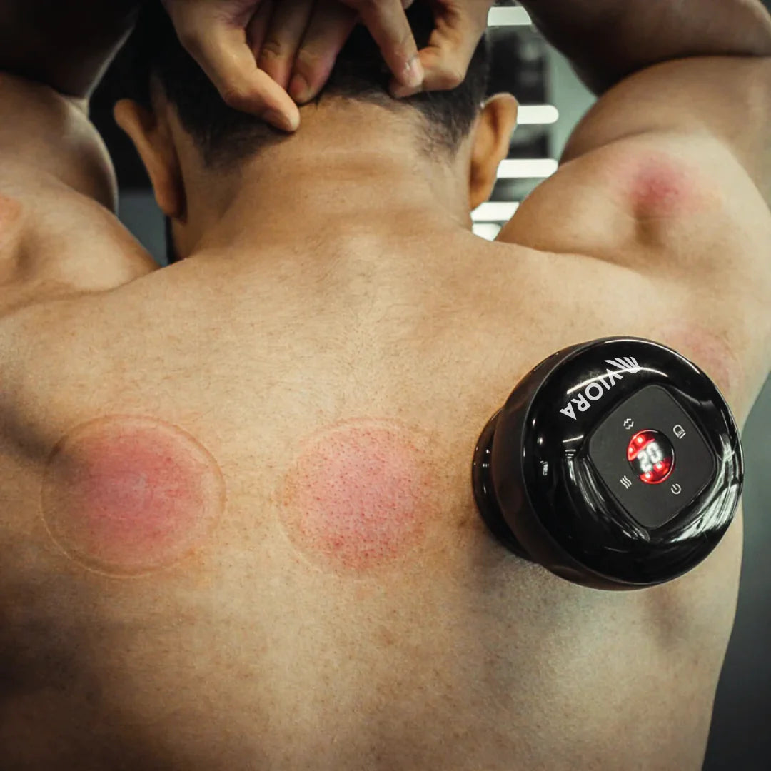 Cupping tegen spierklachten & cellulites