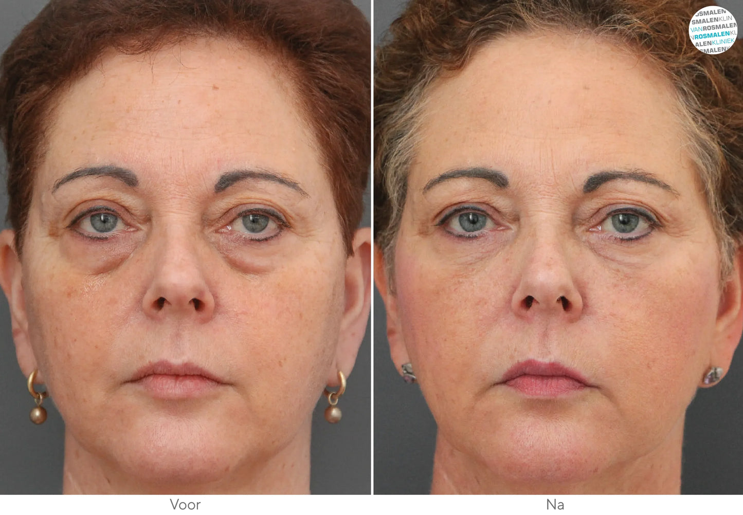 Aloë Vera Collageen Oogmasker | 60 stuks