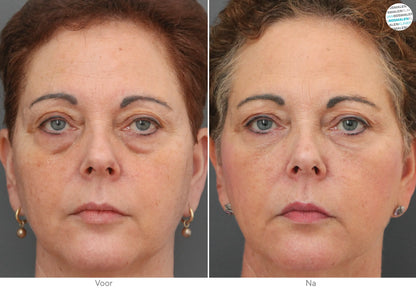 Aloë Vera Collageen Oogmasker | 60 stuks